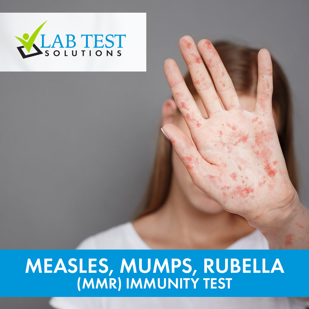 MMR Immunity Profile (Measles, Mumps, Rubella Antibody Test)
