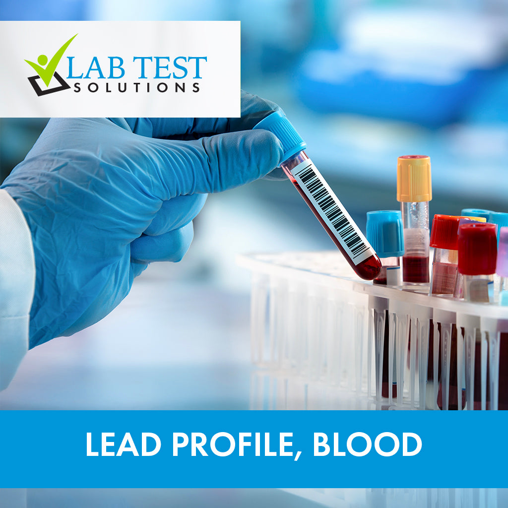 Protecting Your Workers from Lead Exposure with Lab Test Solutions
