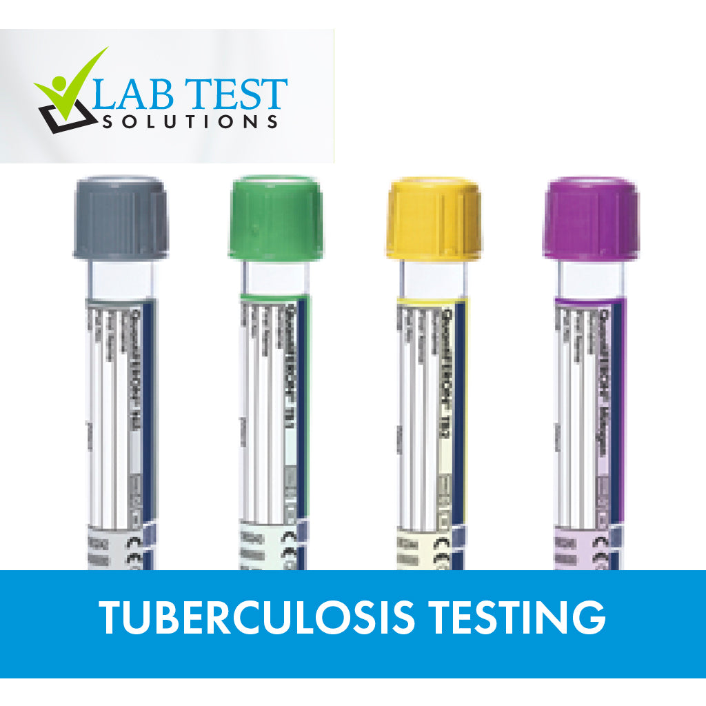 QuantiFERON®-TB Gold Plus: The Gold Standard in Tuberculosis Testing ...