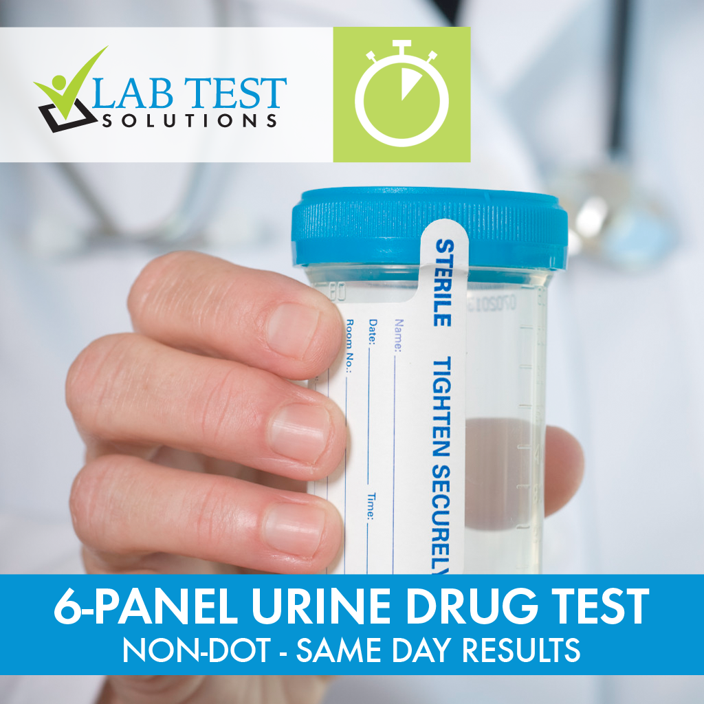 6-Panel RADAR Urine Drug Test - Non-DOT, Same Day Results